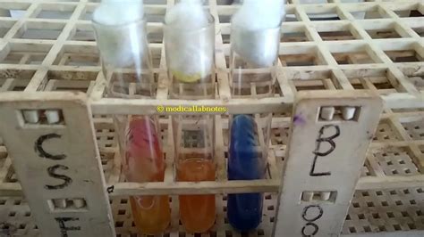 enterobacter aerogenes citrate test|3.17 Biochemical Tests for the Identification of Aerobic Bacteria .